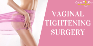 vaginal tightening laser