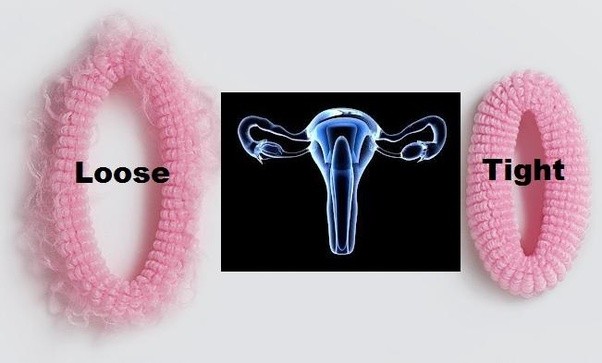 causes of lose vagina